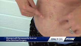 Victim of botched cosmetic surgery in Port St Lucie urging others to come forward [upl. by Armbrecht]