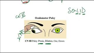 Video 220 Ocular Muscle Innervation amp Cranial Nerve Lesions Anatomy Function amp Clinical Correlates [upl. by Sheena548]