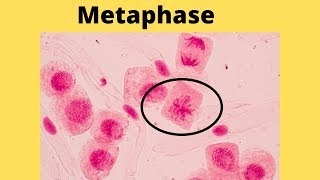 What happens during metaphase [upl. by Ayanej]