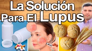 ASÍ CURE MI LUPUS [upl. by Kareem486]