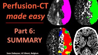 Perfusion CT made easy  part 6  Summary [upl. by Joris710]