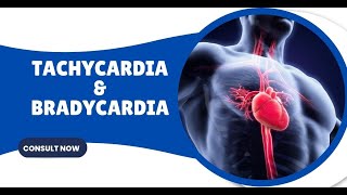 Heart in Harmony or Overdrive Decoding Tachycardia and Bradycardia heart bradycardia tachycardia [upl. by Ormond115]