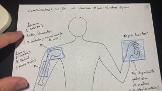 Traumatología Fracturas y complicaciones Esquema 23 [upl. by Yelahc430]