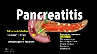 Pancreatitis Acute and Chronic Animation [upl. by Aleta]