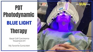 PDT PHOTODYNAMIC BLUE LIGHT THERAPY  Skin Cancer Treatment  Basal Cell Carcinoma  EP04 [upl. by Asaeret279]