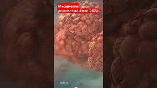 Mycoplasma pneumoniae alert science medicalanimation lunginfection doctor anatomy biology [upl. by Adnohsat]