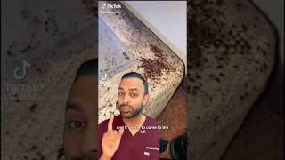 How To Get Rid Of Bed Bugs  Fast Dr Somji Explains [upl. by Thin]