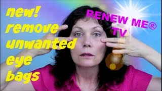 Remove Eye Bags  Under Eye Fluid  Festoons  Malar Bags Using Easy Exercise for Face  FACEROBICS® [upl. by Nahgen]