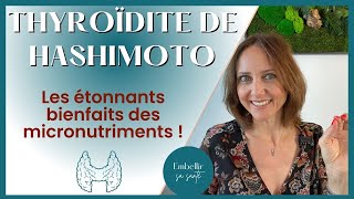 Hypothyroïdie d’Hashimoto régime alimentaire et solutions naturelles [upl. by Schonfield755]