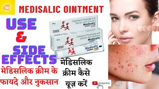 Medisalic oint use side effect मेडिसलिक क्रीम के फायदे और नुकसान medisalic ointment use in hindi [upl. by Stanislaw]