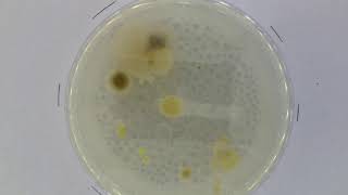 Timelapse Bacterial growth in Petri dish 1 [upl. by Belcher2]