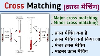 Cross matchingMajor cross matchingminor cross matchingcross matching methodKiran maurya [upl. by Reiners]