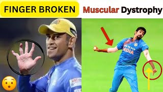 6 Big Cricketer Who are Physically disabled [upl. by Demaggio]