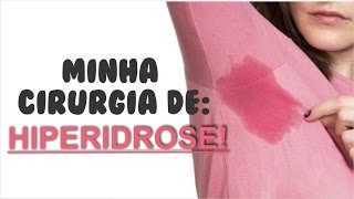 MINHA CIRURGIA DE HIPERIDROSE [upl. by Juliette405]