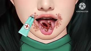 Help 42 from Endless Numbers Blisters Tongue and Smelly Throat Treatment [upl. by Ahker]