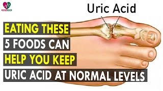 Eating these 5 foods can help you keep uric acid at normal levels  Health Sutra  Best Health Tips [upl. by Otha]