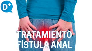 Diagnóstico y tratamiento de la fístula anal [upl. by Gerson]