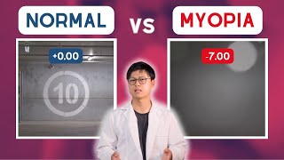 MYOPIA vs normal vision POV [upl. by Einnim833]