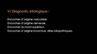 RADIOLOGIE Encoches Costales [upl. by Eninnej]