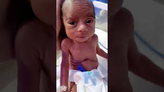 preterm birth 12 days baby God bless you baby 🐥🍼viralvideo trandingshorts childbirth newborn [upl. by Dhiren272]