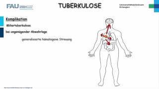 Pathologie ─ Tuberkulose [upl. by Rodmann]