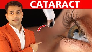 Eat This Every Day To Prevent Your Eyes From Cataract  Dr Vivek Joshi [upl. by Ardnoel625]