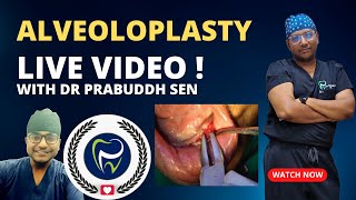 Dr Rudra Mohan  ALVEOLOPLASTY PROCEDURE LIVE  Preprosthetic Surgery  Smoothening Rough Jaw Bone [upl. by Lorenzana]