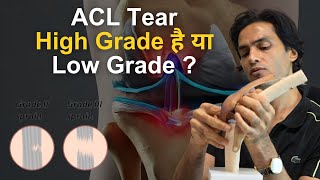 ACL सर्जरी के लिए कौनसा graft चुनें  Different Types and Best Graft for ACL Ligament Surgery [upl. by Atteynod]