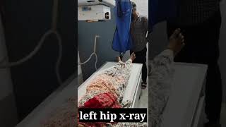 left hip xray youtuber facts doctor youtubeshort [upl. by Holli]