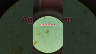 Cross match blood reaction when two different blood samples mixsimple way of cross match [upl. by Woodberry]