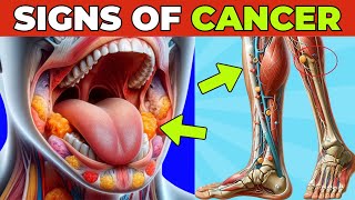 9 Common and Overlooked Signs of CANCER [upl. by Idleman62]