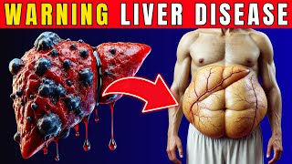 10 Skin signs of Liver Disease  Fatty liver  Cirrhosis of the Liver Healthy Care [upl. by Ahsimac]