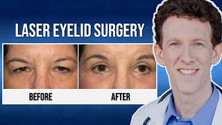 Laser Eyelid Surgery with Dr Adam Scheiner  Thelmas Testimonial [upl. by Klina435]