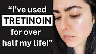 My 22YEAR Tretinoin Experience The Key to Youthful Skin for Over 2 Decades [upl. by Joon]