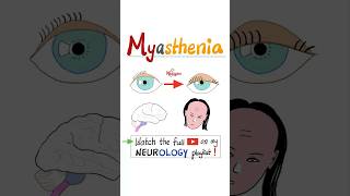 Myasthenia Gravis MG  Muscle Weakness Fatigue…science anatomy pathology health nurse mbbs [upl. by Mauricio]