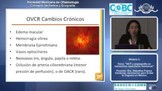 OCT y angiografía en oclusiones vasculares retinianas  Dra Valentina Franco Cárdenas [upl. by Beichner]