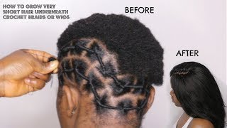 HOW TO GROW TWA HAIR UNDERNEATH CROCHET BRAIDS [upl. by Barling799]