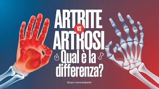 Artrite vs Artrosi Differenze E Strategie Di Gestione [upl. by Sidnak]