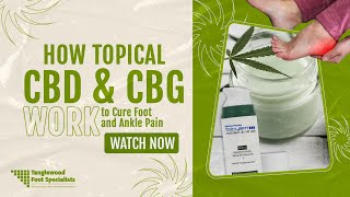 How Topical CBD and CBG Work to Cure Foot and Ankle Pain [upl. by Immac]