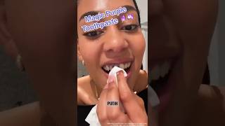 Magic purple toothpaste Hismile V34 shortvideo trending ytshorts magic toothpaste [upl. by Nevag676]