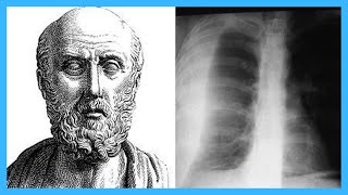 Top 12 Contributions of Hippocrates [upl. by Dumond]