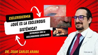 Esclerosis Sistémica y Esclerodermia localizada diferencias y características [upl. by Zeuqirdor]