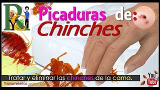 🕷️🐛 Picaduras de chinches  Piquetes de chinches  Como eliminar chinches de la cama picaduras 🛏️ [upl. by Bevers]