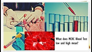 MCHC Blood Test  Low Normal High [upl. by Munafo]