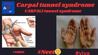 Clinical Insights into Carpal Tunnel Syndrome An Anatomy Guide कार्पल टनल सिंड्रोम Livealife55 [upl. by Patrich]