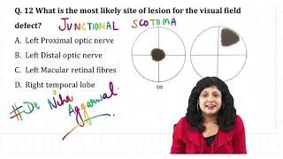 Junctional Scotoma  Dr Niha Aggarwal [upl. by Godderd445]