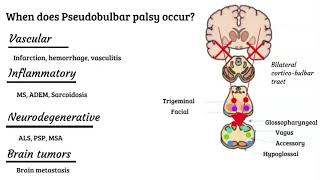 Bulbar vs pseudobulbar palsy [upl. by Ricky]