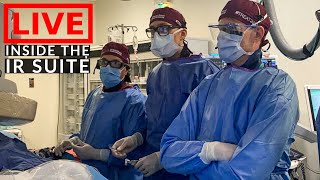 LIVE Procedure  BTS  Day in the Life of a DOCTOR  Interventional Radiology [upl. by Gauthier]