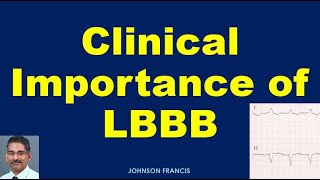 Clinical Importance of LBBB [upl. by Vincents]