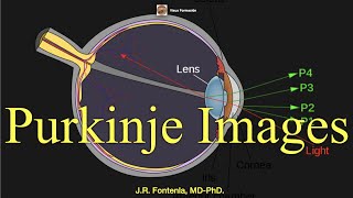 Purkinje Images PurkinjeSanson images [upl. by Sausa]